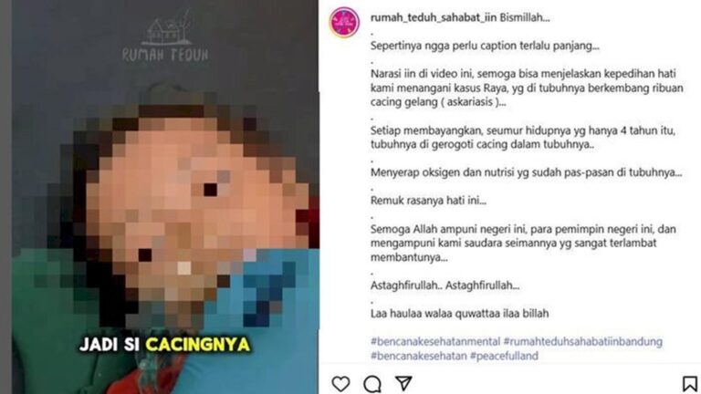 Tragedi Raya, Balita Sukabumi yang Meninggal usai Tubuh Dipenuhi Cacing Gelang