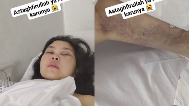 PMI Asal Tegalbuleud Sukabumi Terbaring Lemah di Dubai, Diduga Dianiaya Majikan