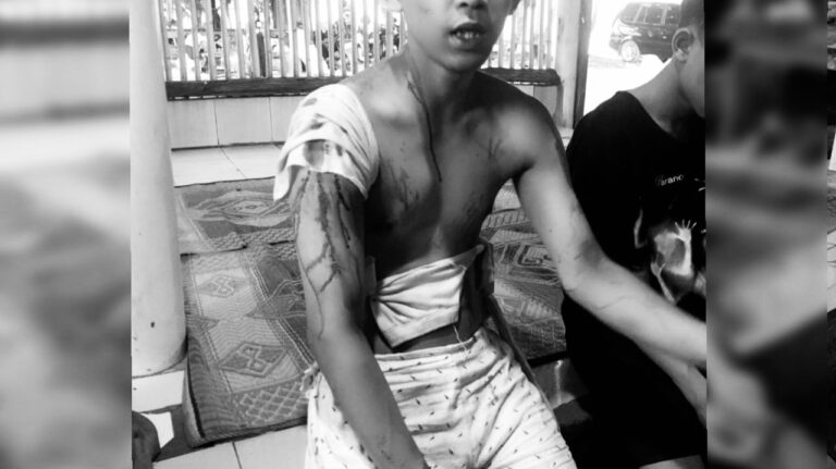 2 Wisatawan Cianjur Jadi Korban Perampokan saat Berkemah di Pantai Cibuaya Sukabumi, 1 Alami Luka Bacok