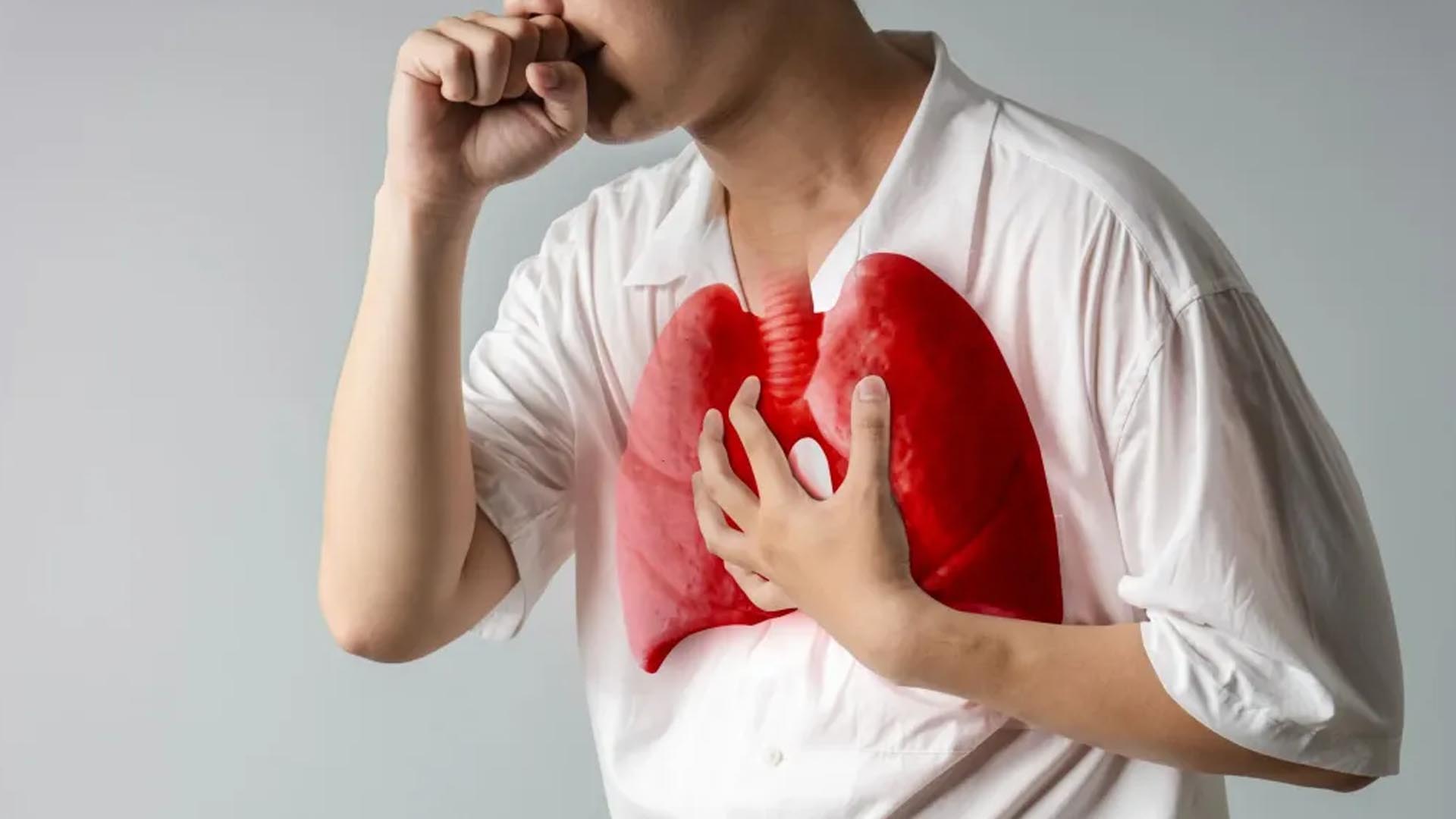 Ilustrasi warga terkena penyakit di paru-paru. | Foto: Ist